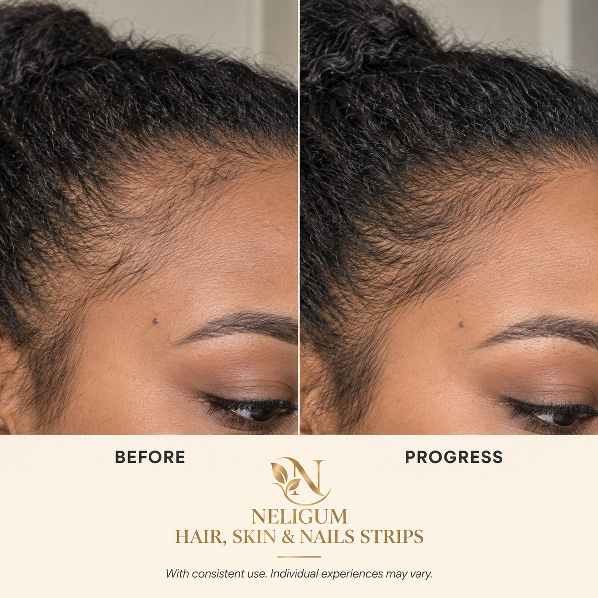 Neligum Hair, Skin and Nails Oral Strips